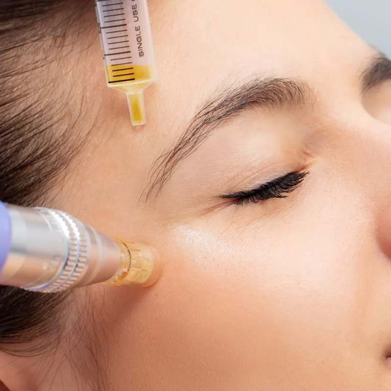 Làm PRP Bao Lâu Thì Đẹp? Tiêm Huyết Tương Giàu Tiểu Cầu Làm Đẹp Da Bao Lâu 1 Lần?