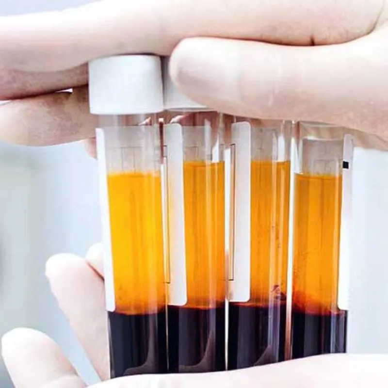 Lấy máu và tách chiết PRP