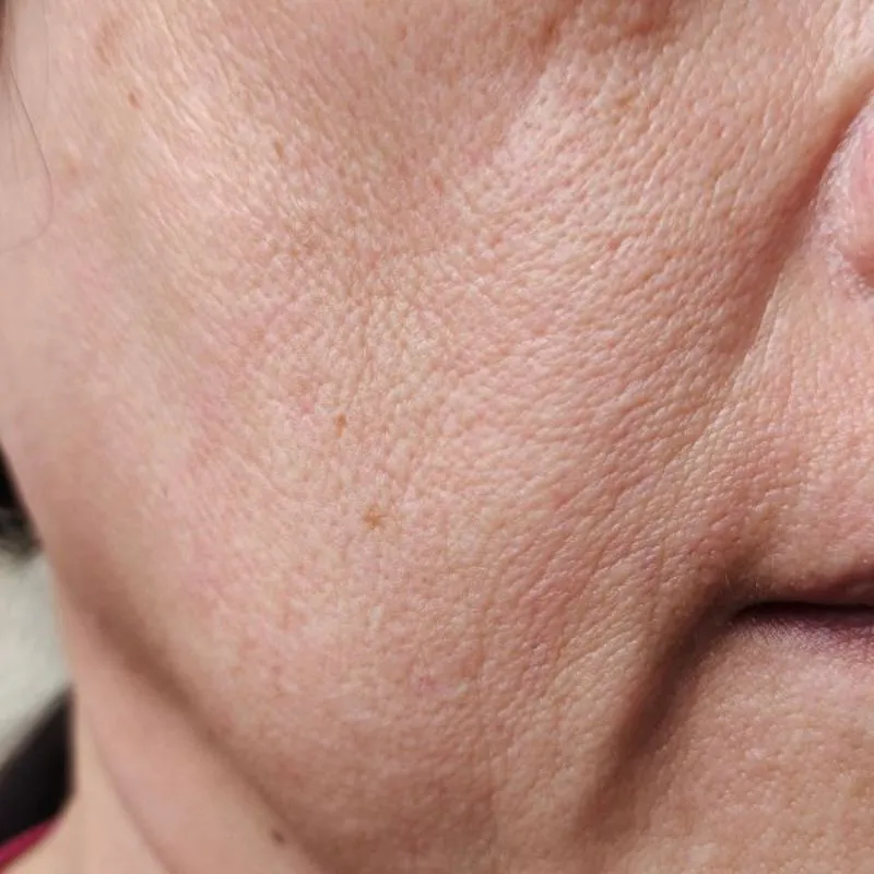 Da mỏng và dễ kích ứng