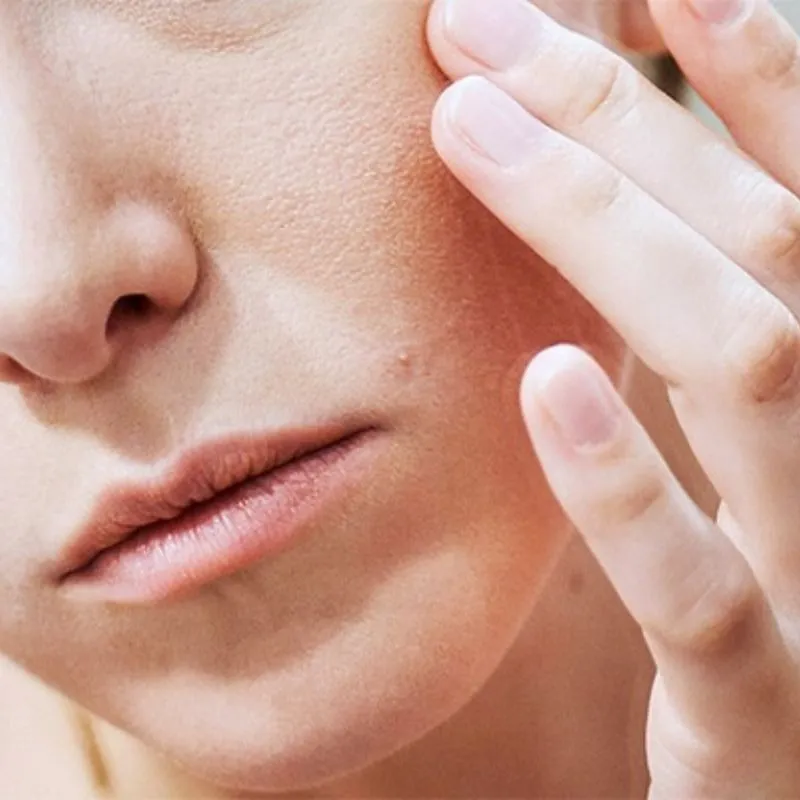 Da khô và kém đàn hồi