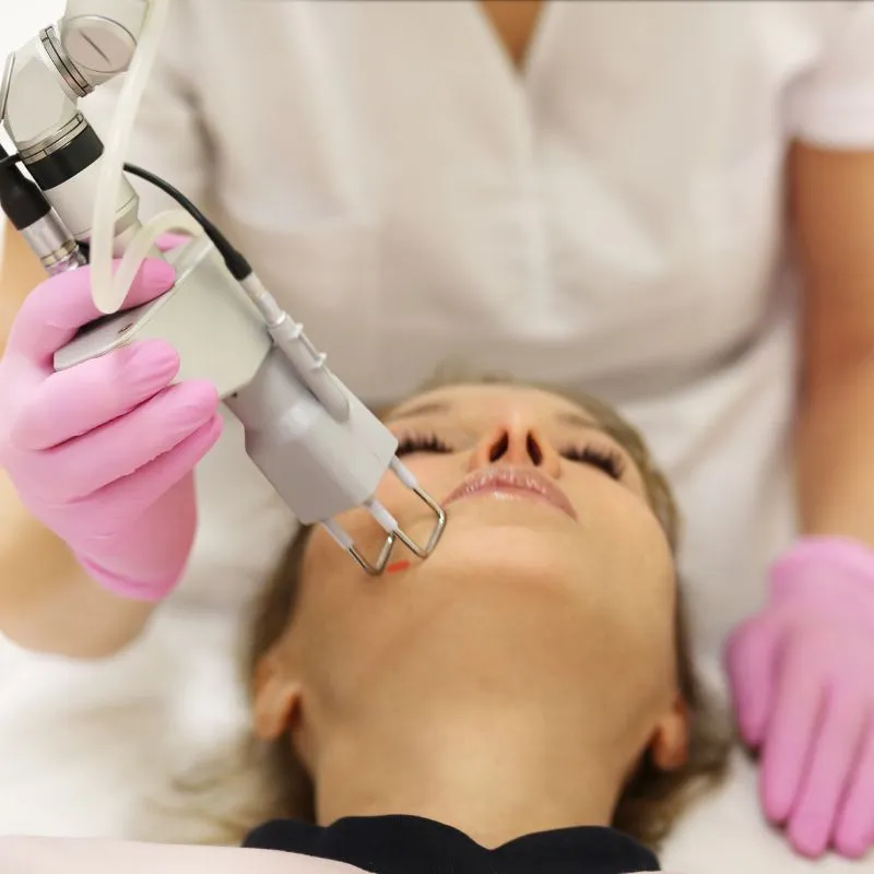 tìm hiểu phương pháp Laser fraction CO2 là gì?