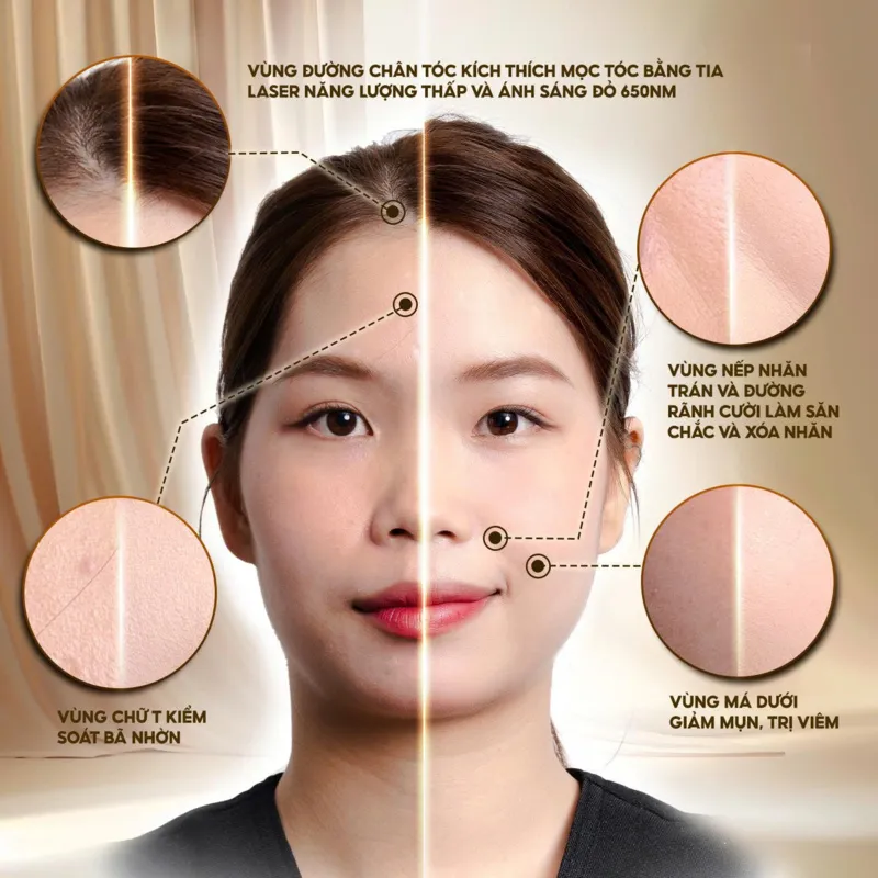 Hiệu quả trên da của mặt nạ ánh sáng sinh học KATA Miro L2Pro