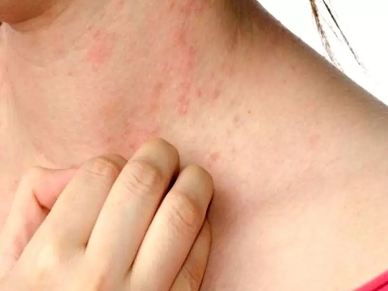 Khi da bị viêm nhiễm hoặc có vết thương thì không nên sử dụng máy