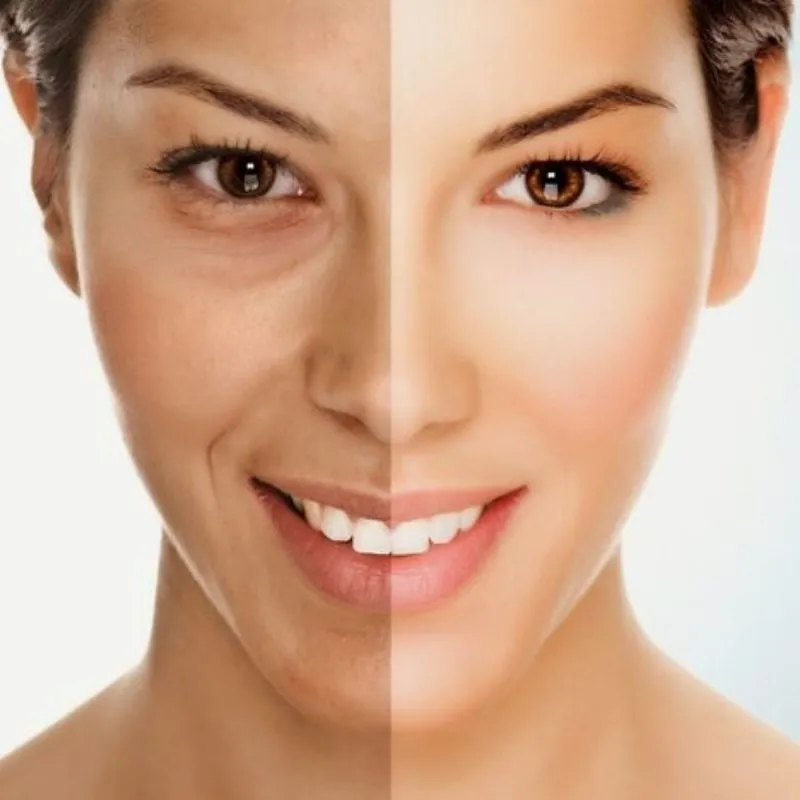 Serum Peptide giúp tăng cường độ đàn hồi