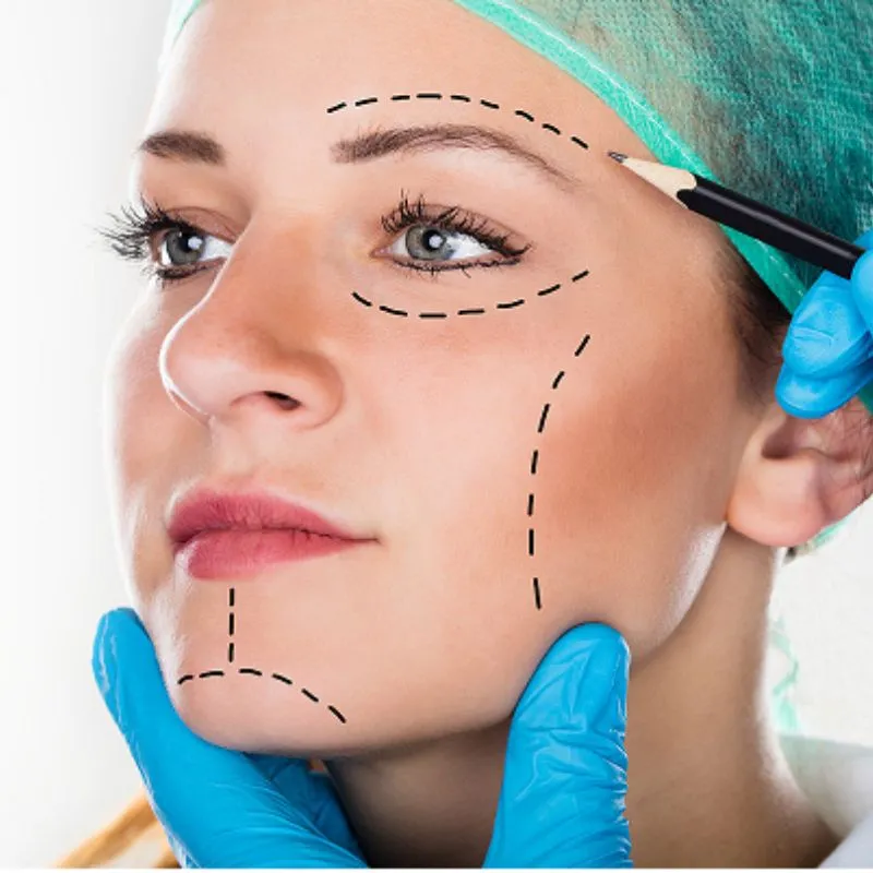 Phẫu thuật căng da mặt là gì?