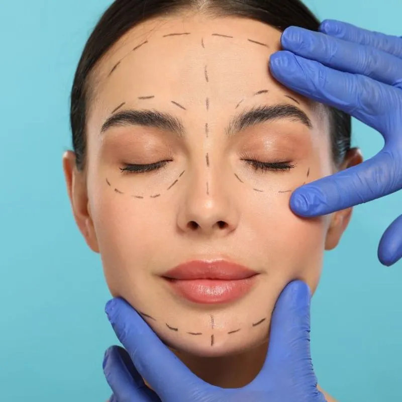  Đối tượng phù hợp để thực hiện phẫu thuật căng da mặt 