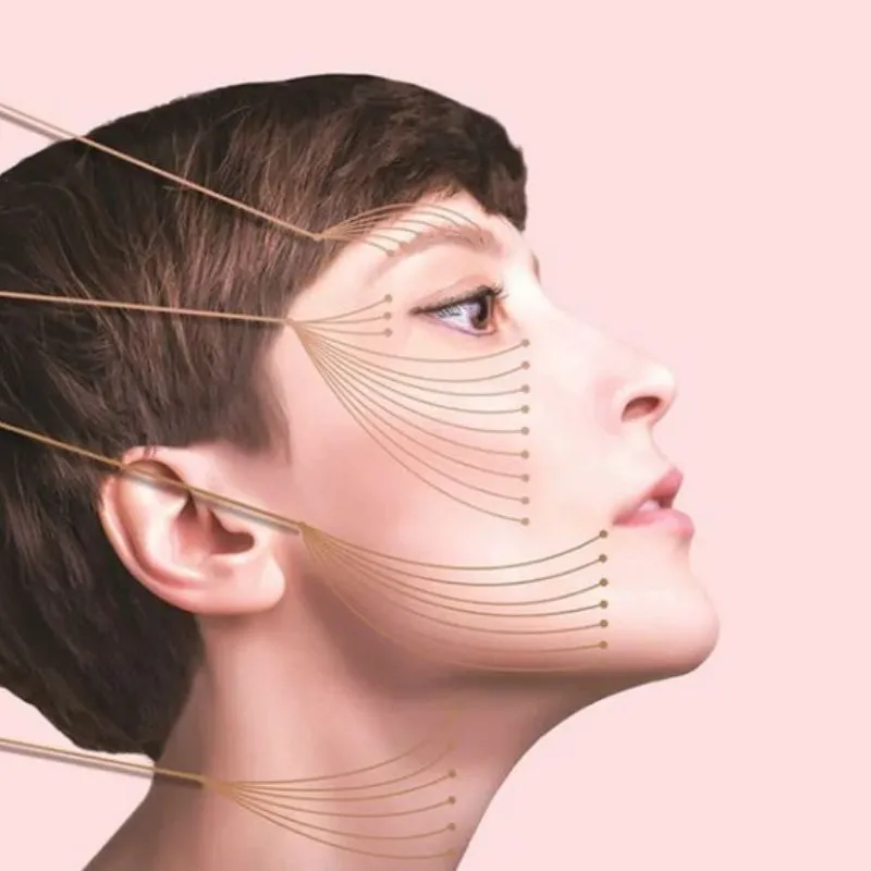 lưu ý quan trọng sau khi thực hiện phẫu thuật căng da mặt 