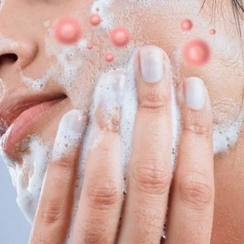 Rửa mặt nhiều có hết mụn không?