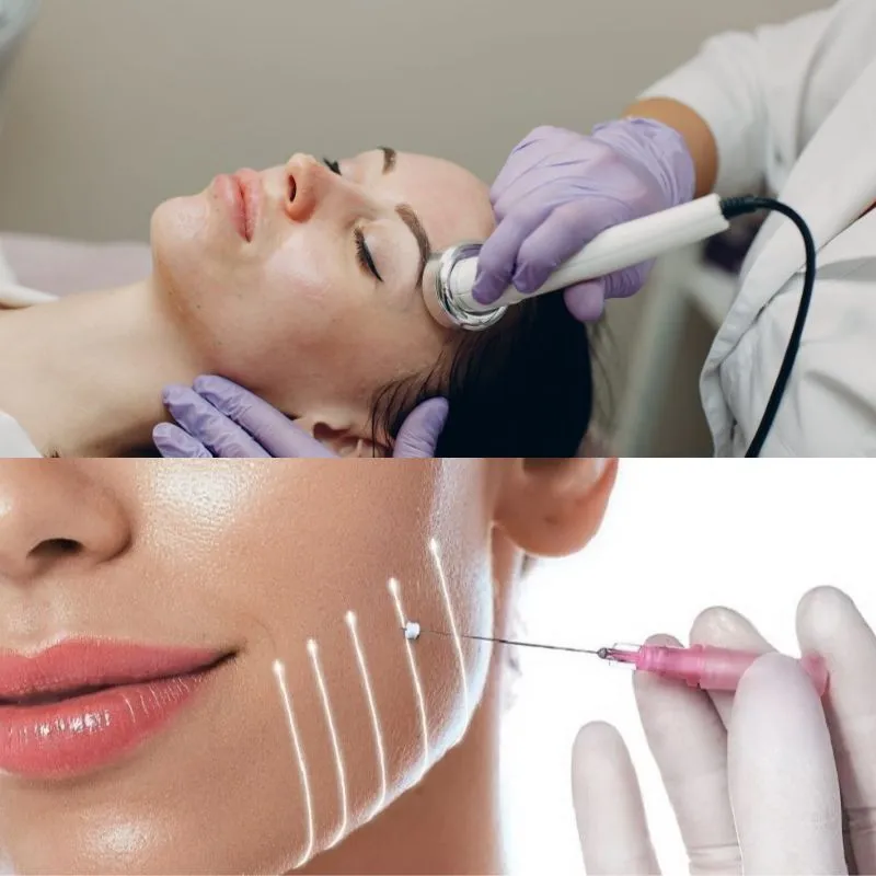 So Sánh Phương Pháp Điện Di Tinh Chất Và Cấy Chỉ Collagen