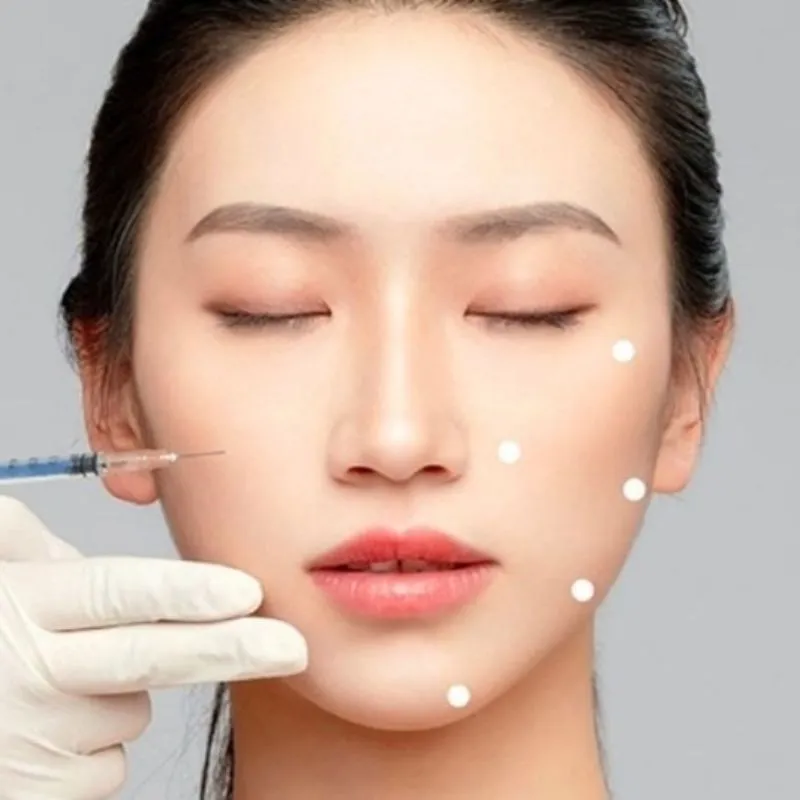 Tiêm filler