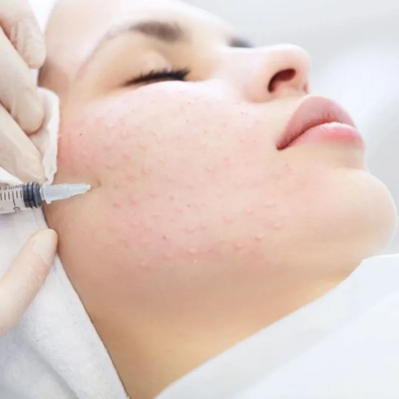Phương pháp điện di vi điểm là phương pháp xâm lấm nhẹ để đưa dưỡng chất trực tiếp vào trong da
