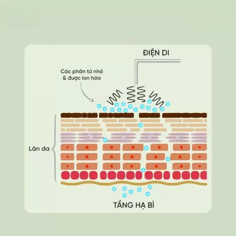 Công nghệ EMS