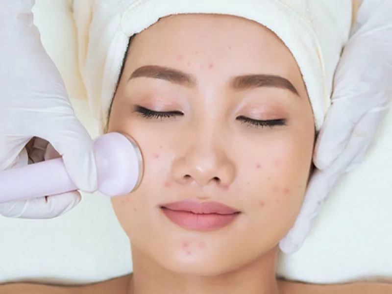 Phương pháp điện di lạnh được sử dụng thường xuyên trong thẩm mỹ