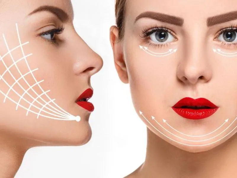 5 nhược điểm của công nghệ làm đẹp tái sinh đa tầng 