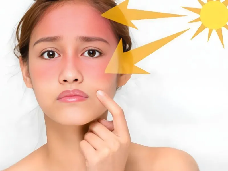 Tác hại của tia UV