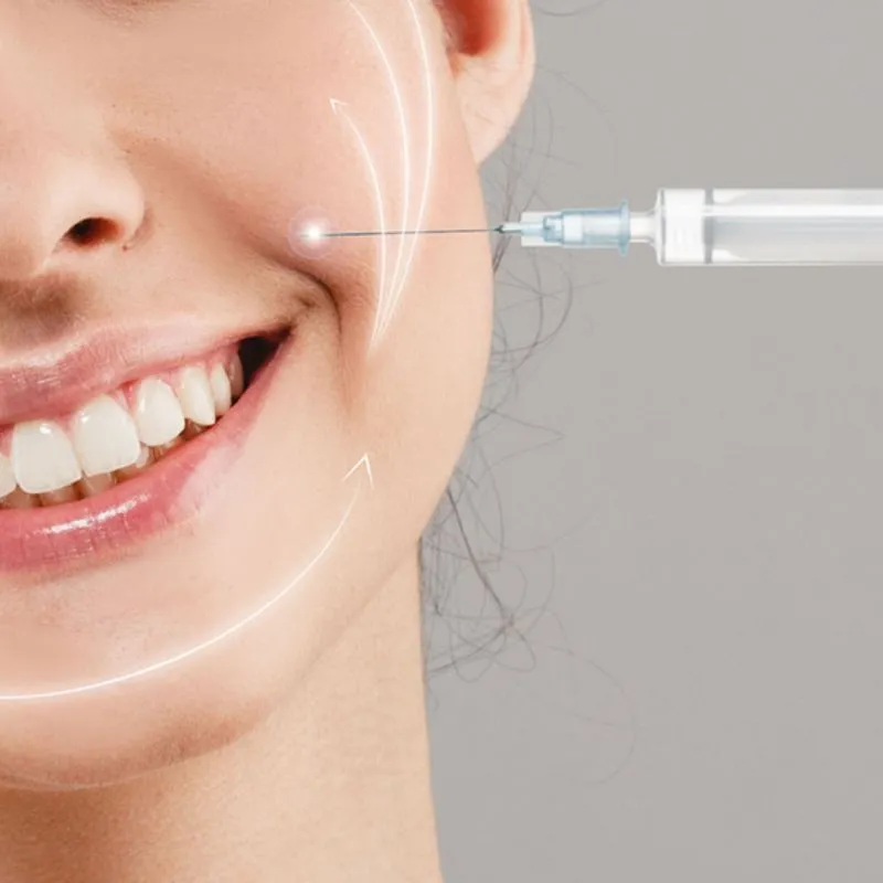 Tiêm Rãnh Cười Bao Lâu Thì Đẹp? Có Biến Chứng  Tiêm Filler Rãnh Cười Không?