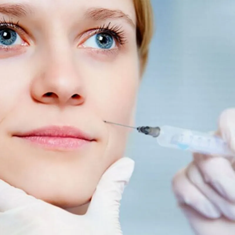 Tiêm rãnh cười bằng filler cứng hay mềm?