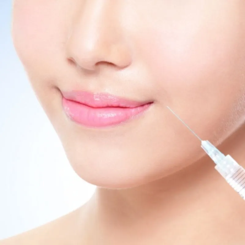 Có biến chứng tiêm filler rãnh cười không?