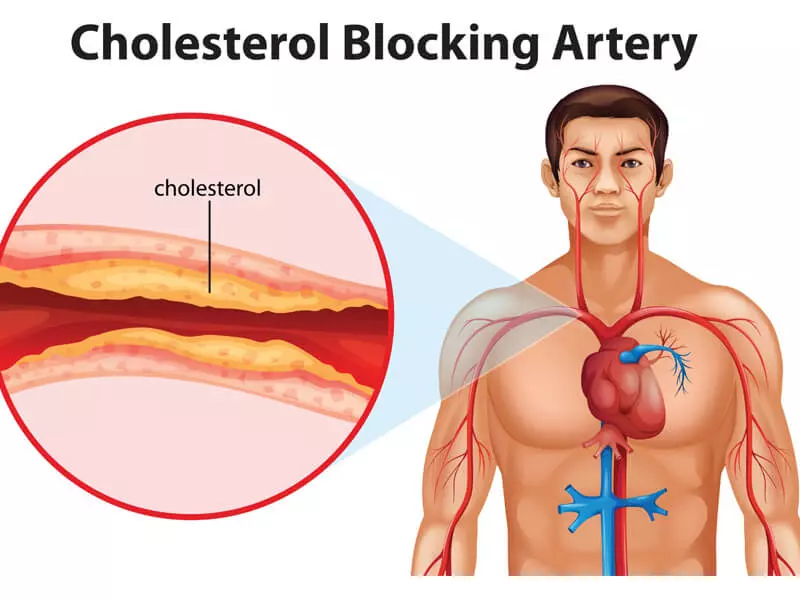Xoài có khả năng giảm nồng độ cholesterol xấu và ổn định huyết áp
