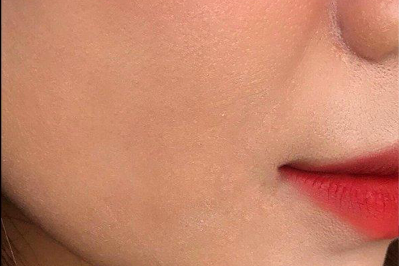 Lớp nền có thể bị ngả vàng, hồng hoặc xám tùy theo chất lượng ánh sáng