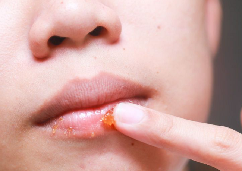 Tẩy da chết môi để son bám màu tốt hơn