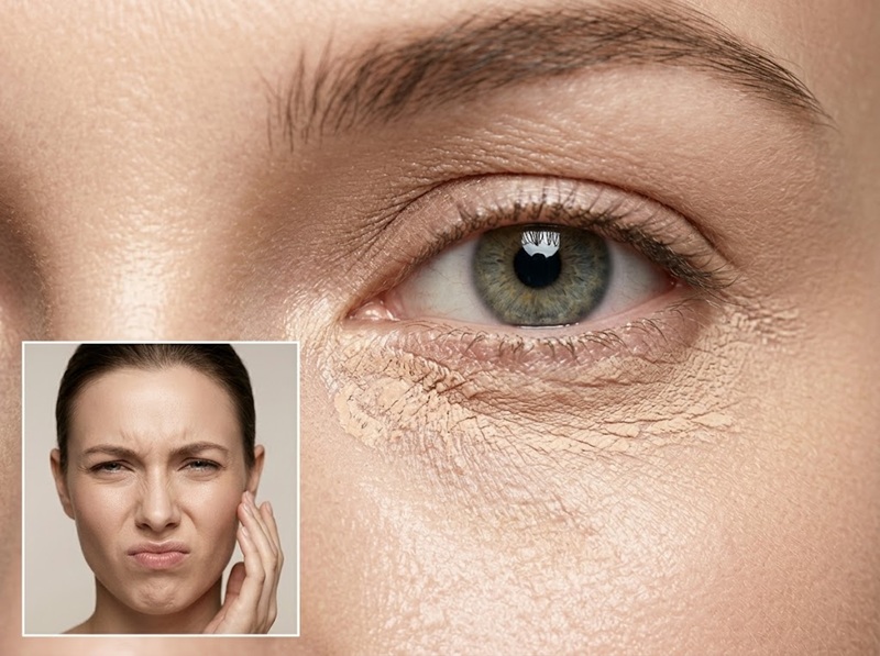 Hiện tượng kem bị đọng vào nếp gấp mí sau vài giờ là nỗi ám ảnh của phái đẹp