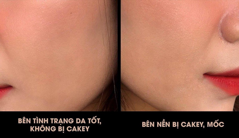 Hiện tượng mốc nền không chỉ làm giảm thẩm mỹ mà còn khiến kết cấu da trông thô ráp