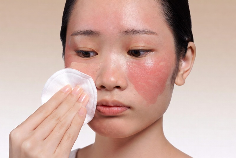 Tẩy trang quá mạnh sẽ phá vỡ lớp màng bảo vệ tự nhiên khiến da đỏ rát, châm chích