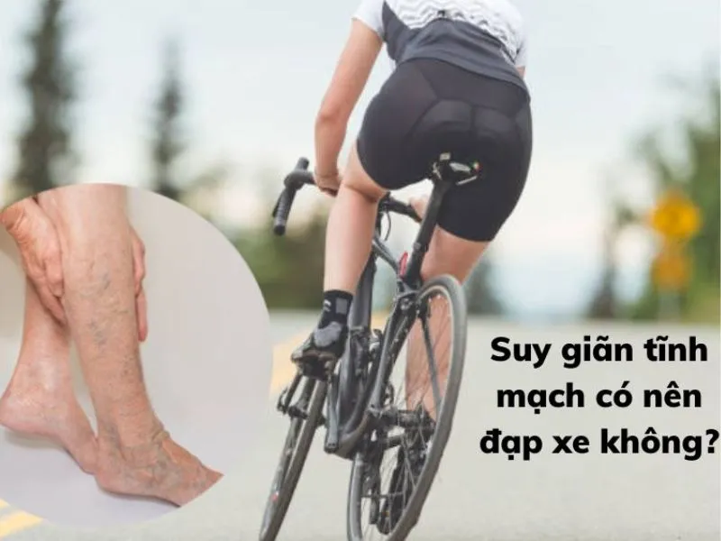 Bị giãn tĩnh mạch chân có nên đạp xe, bơi lội không?