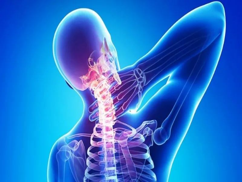 Các biểu hiện thường gặp khi bị đau dây thần kinh ở cổ 