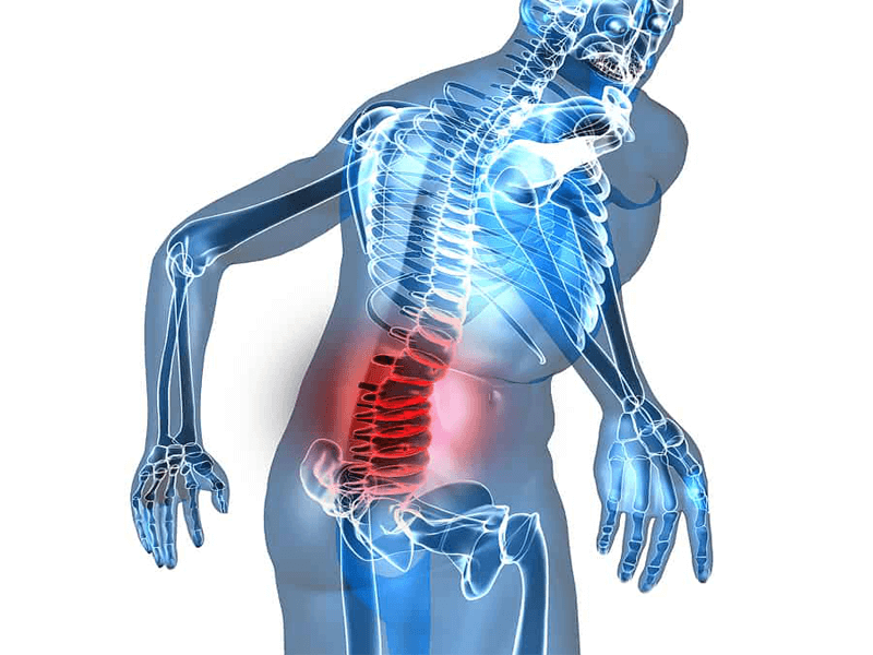 Bị đau lưng dưới là bệnh phổ biến hiện nay