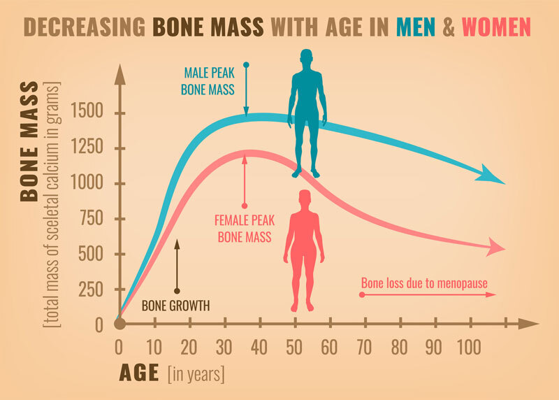 Chỉ số khối lượng xương là gì?