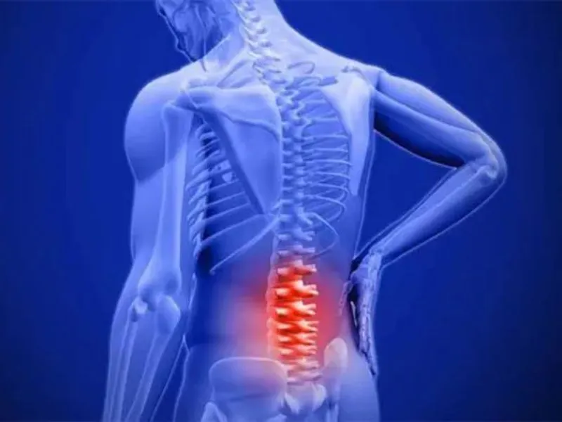 Cảnh báo các bệnh liên quan đến đau lưng cần cẩn thận 