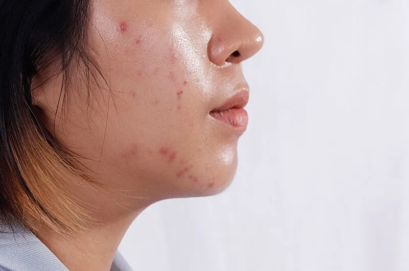 Tại sao cần học các bước trang điểm cho da dầu?