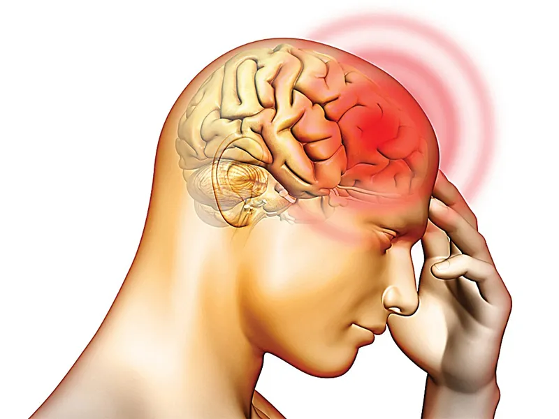 Chấn thương sọ não có thể gây nên cơn đau đầu chóng mặt