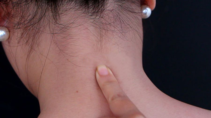 Sử dụng ngón tay trỏ ấn nhẹ nhàng dọc theo đốt sống cổ xuống vùng vai gáy để thực hiện kỹ thuật massage cổ vai gáy