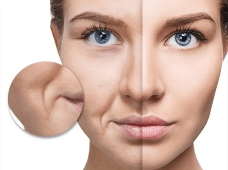 Bật Mí Cách Trang Điểm Che Rãnh Cười Không Đọng Nền 