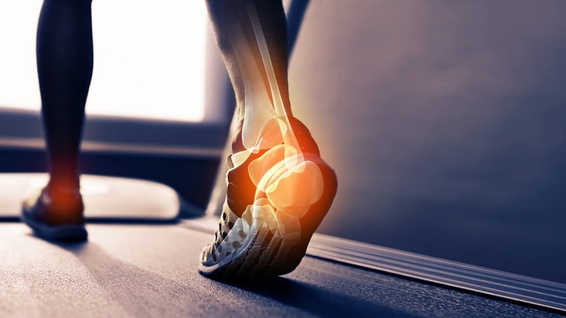 Trong trường hợp không có biểu hiện đau, bàn chân bị gãy xương sưng nặng nề hơn so với bàn chân không bị gãy xương