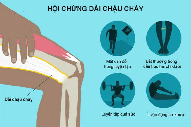 Hội chứng dải chậu chày là một trong những nguyên nhân dẫn đến hiện tượng chạy bộ bị đau đầu gối