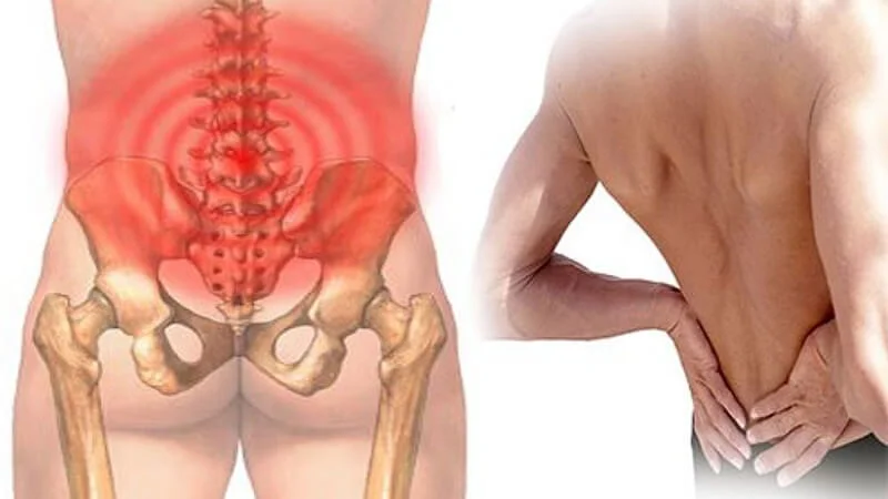 Đau lưng là bệnh lý thường gặp ở nhiều người