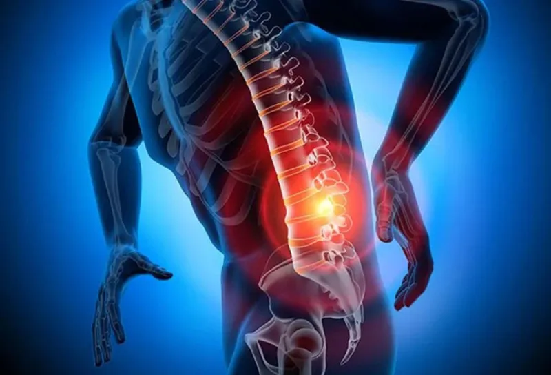 Tìm hiểu triệu chứng giãn dây chằng lưng để có phương pháp điều trị hiệu quả