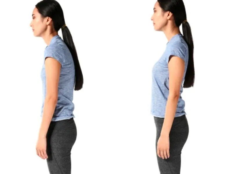 Nhận biết triệu chứng hội chứng cột sống thắt lưng