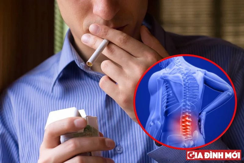Lý do nào dẫn đến những cơn đau lưng của bạn?