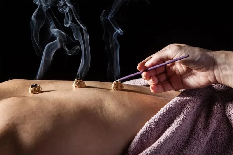 Giải mã liệu pháp Moxibustion ứng dụng trên máy massage hiện đại