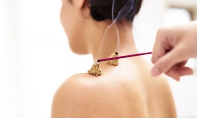 Moxibustion tăng cường tuần hoàn máu