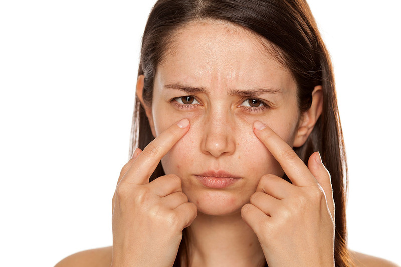 Bọng mắt, quầng thâm là hai nhân tố hàng đầu khiến cho gương mặt trở nên thiếu sức sống