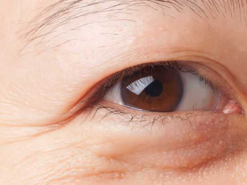Vùng mắt bị lão hoá là vấn đề không thể tránh khỏi trong cuộc đời của con người
