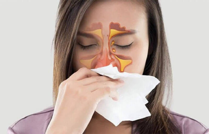 Đau đầu gây ra triệu chứng viêm xoang mũi