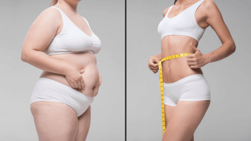 Những nguy cơ tiềm ẩn khi cơ thể quá nhiều mỡ nội tạng Visceral Fat