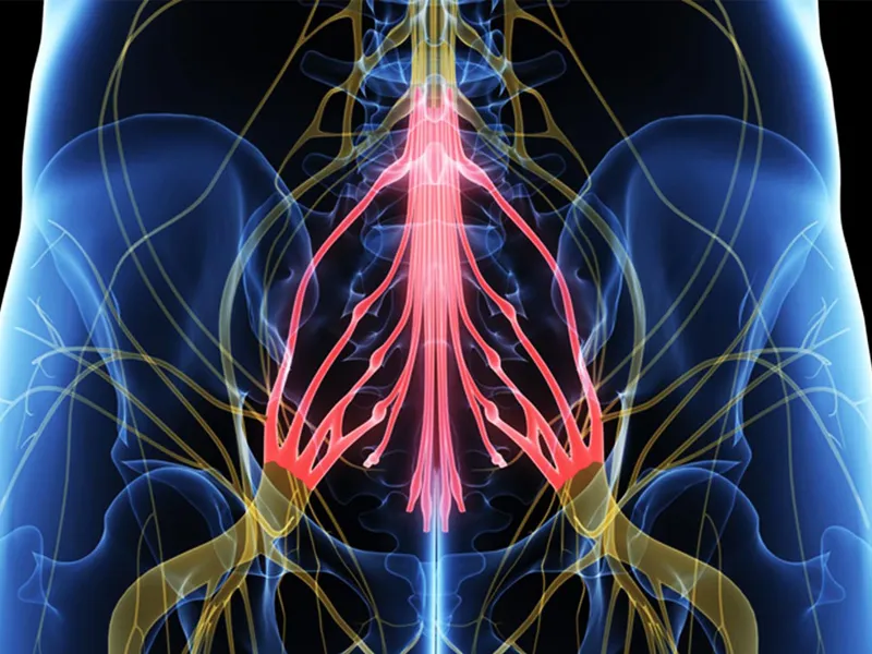Hội chứng đuôi ngựa: Rễ thần kinh ở vùng thắt lưng bị chèn ép